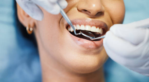 Best Emergency Dental Filling Replacement  in Tn Lakes, WI